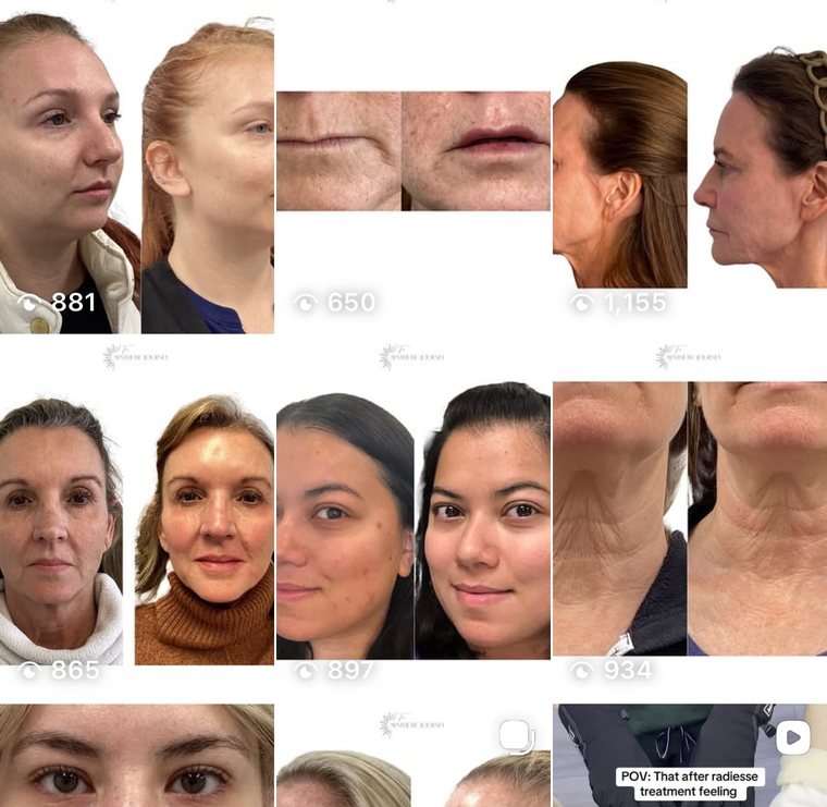 The Aesthetic Journey — before